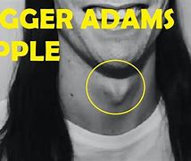 Image result for Biggest Adam's Apple