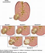 Image result for 8Mm Cyst