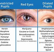 Image result for Red Eyes Drugs