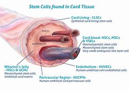 Image result for Cord Blood Mesenchymal Stem Cells