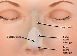 Image result for Nose Bone Pain