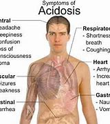 Image result for acidozis