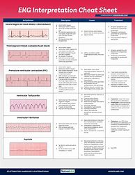 Image result for EKG Nursing Cheat Sheet