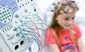 Image result for EEG Children