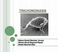 Image result for Trichomoniasis Slide