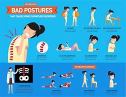 Image result for Examples of Bad Posture
