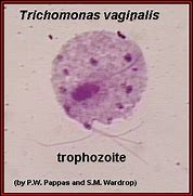 Image result for Trichomonas Vaginalis