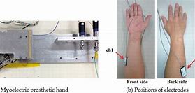 Image result for prosthetics hands sensory feedback