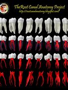 Image result for 1st Molar Tooth