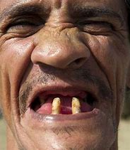 Image result for People with Funny Teeth