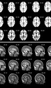 Image result for Healthy Human Adult Brain