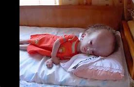 Image result for Hydranencephaly Oldest Survivor