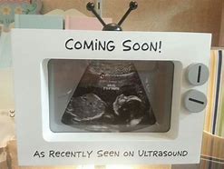 Image result for Cute Ways to Display Ultrasound
