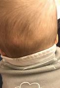 Image result for Toddler Bump On Head