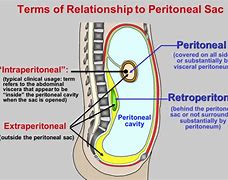 intraperitoneal 的图像结果