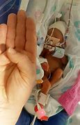 Image result for Premature Baby 2Lb