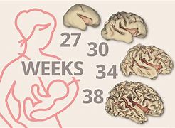 Image result for Premature Baby Brain