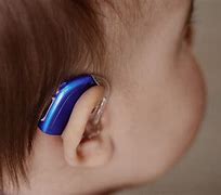 Image result for Hearing Aids for Kids