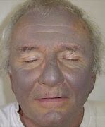 Image result for Overdose Grey Skin