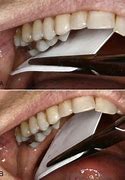 Image result for Dental Film Digitizer