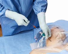 Image result for Venous Access Apheresis