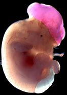 Image result for Neural Tube or Tail