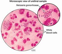 Image result for Gonorrhea Gram Stain