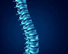 Image result for Collapsed Disc in Back