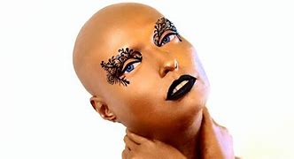 Image result for alopefia