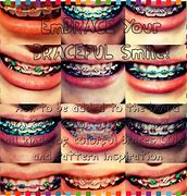 Image result for Cool Braces Ideas