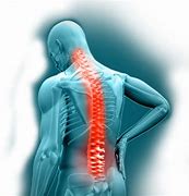 Image result for Back Pain Relief Chiropractic