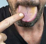 Image result for Yellow Face Mouth