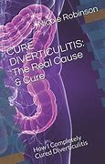 Image result for Diverticulitis