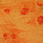 Image result for PMN Gram Stain