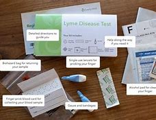 Image result for Lyme Disease Test Kit
