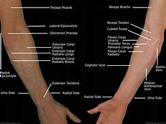 Image result for Sharp Pain Lower Arm
