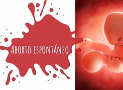 Image result for abortad