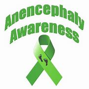 Image result for Anencephaly Awareness Bracelet