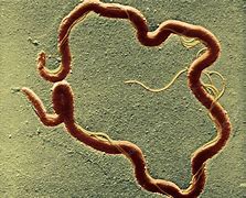 Image result for Syphilis Bacteria