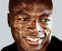 Image result for Seal Face Scars