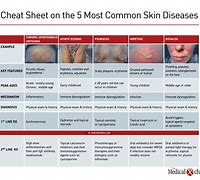 Image result for Scary Skin Diseases