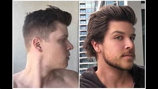 Image result for 4 Month Hair Growth