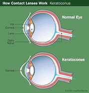 Image result for Black Eye Contact Lenses