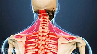 Image result for Chiropractor Poses for Neck and Back Pain