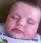 Image result for Babies with Pimples