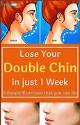 Image result for Fat Freezing Double Chin