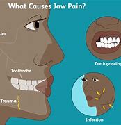 Image result for Upper Jaw Pain
