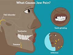 Image result for Teeth Stuck in Your Jawbone