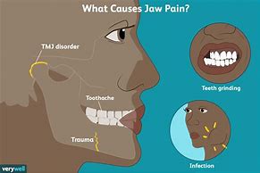 Image result for Lower Jaw Pain