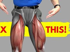 Image result for What to Do When Your Legs Hurt